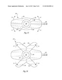 STABILIZED IMPLANTABLE VASCULAR ACCESS PORT diagram and image