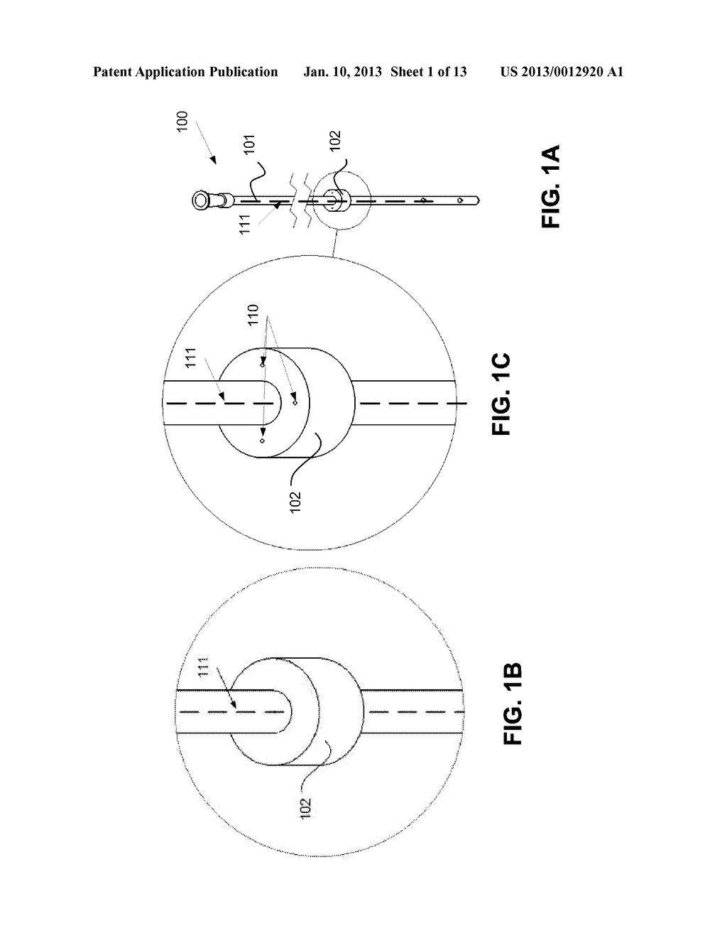 NASO/OROGASTRIC TUBE HAVING ONE OR MORE BACKFLOW BLOCKING ELEMENTS,     BACKFLOW BLOCKING ELEMENTS, AND A METHOD OF USING BACKFLOW BLOCKING     ELEMENTS - diagram, schematic, and image 02