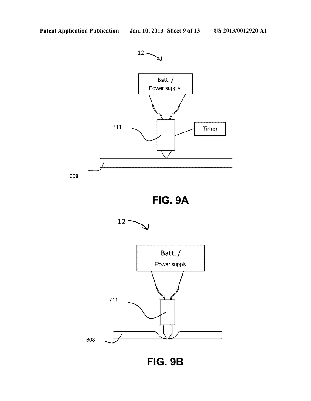 NASO/OROGASTRIC TUBE HAVING ONE OR MORE BACKFLOW BLOCKING ELEMENTS,     BACKFLOW BLOCKING ELEMENTS, AND A METHOD OF USING BACKFLOW BLOCKING     ELEMENTS - diagram, schematic, and image 10