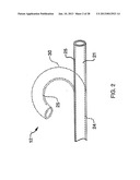 DEFLECTABLE SHEATH CATHETERS diagram and image