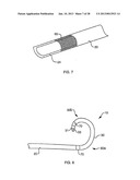 DEFLECTABLE SHEATH CATHETERS diagram and image