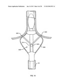 DEFLECTABLE SHEATH CATHETERS diagram and image