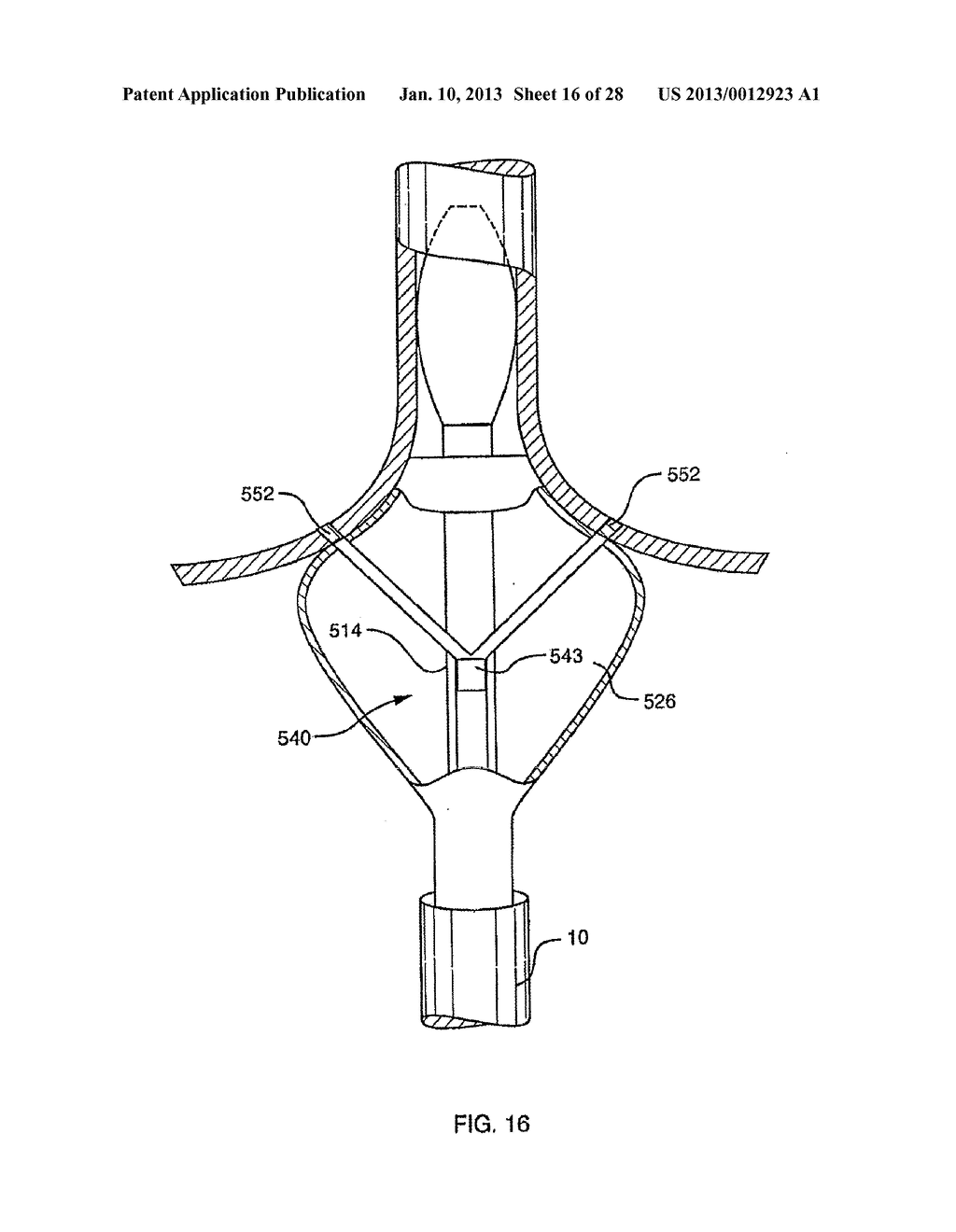 DEFLECTABLE SHEATH CATHETERS - diagram, schematic, and image 17