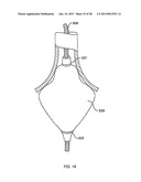 DEFLECTABLE SHEATH CATHETERS diagram and image