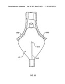 DEFLECTABLE SHEATH CATHETERS diagram and image