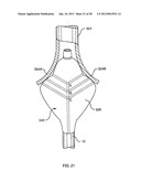 DEFLECTABLE SHEATH CATHETERS diagram and image