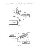 DEFLECTABLE SHEATH CATHETERS diagram and image