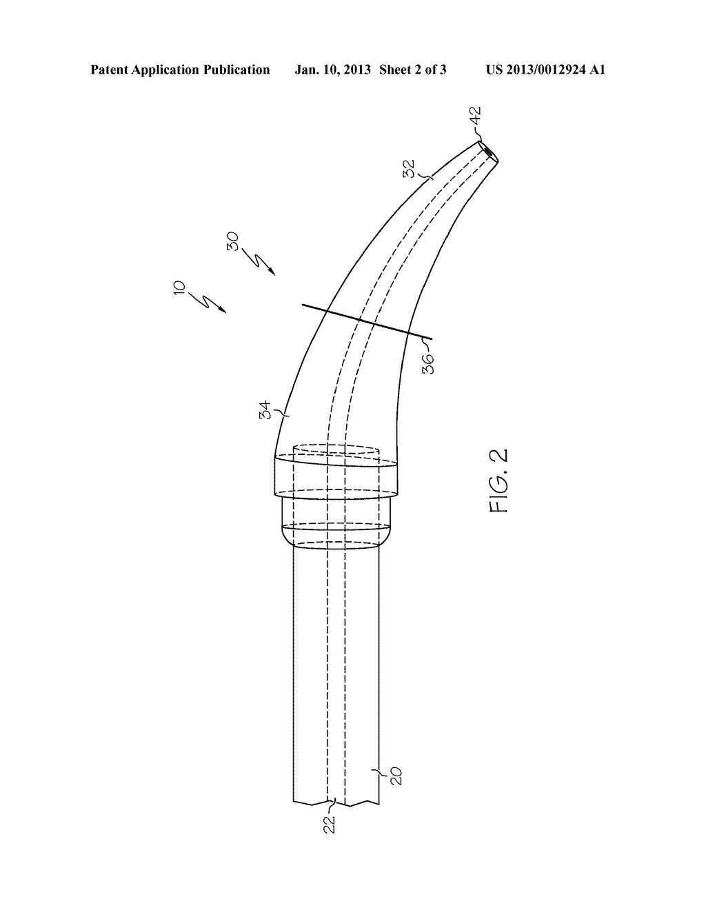 Dual Durometer Soft/Flexible Enhanced Bond Strength Guiding Tip - diagram, schematic, and image 03