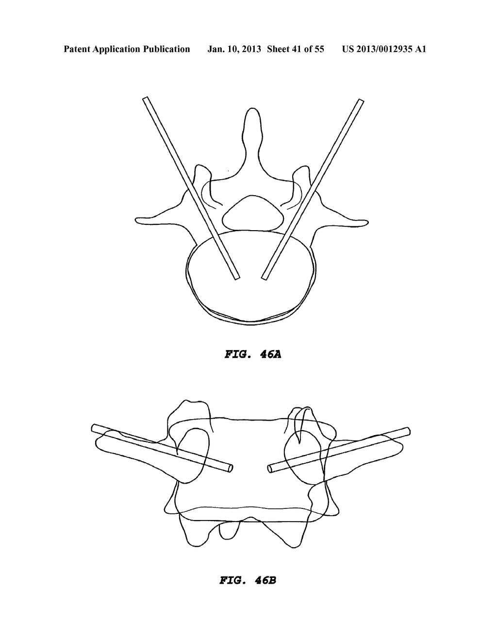 METHODS OF TREATING BACK PAIN - diagram, schematic, and image 42