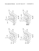 DEVICE AND METHOD FOR RADIO FREQUENCY ABLATION (RFA) diagram and image