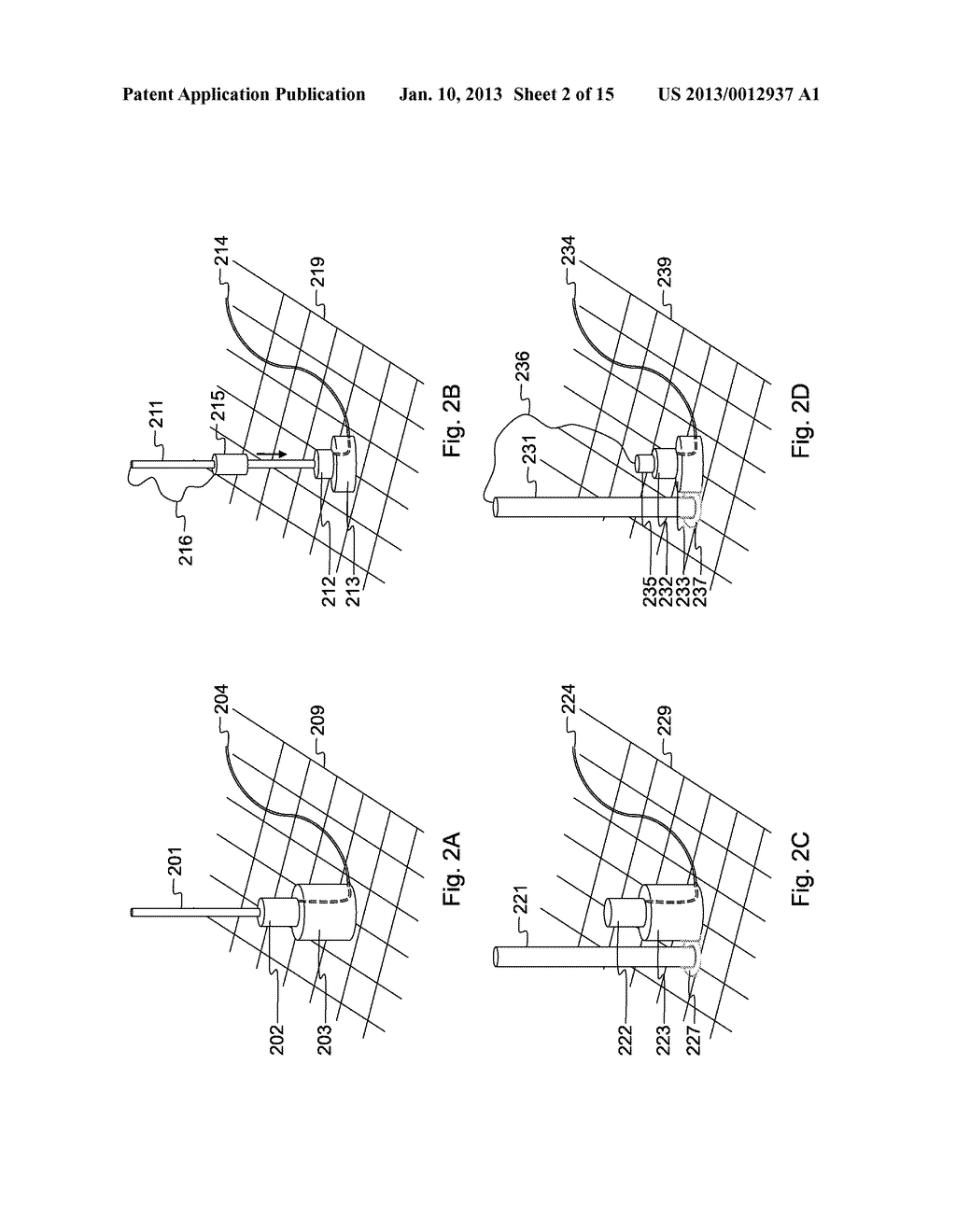 DEVICE AND METHOD FOR RADIO FREQUENCY ABLATION (RFA) - diagram, schematic, and image 03