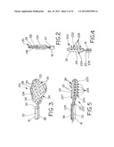 Device and Method for Treating Cardiac Disorders by Modulating Autonomic     Response diagram and image