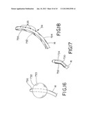 Device and Method for Treating Cardiac Disorders by Modulating Autonomic     Response diagram and image