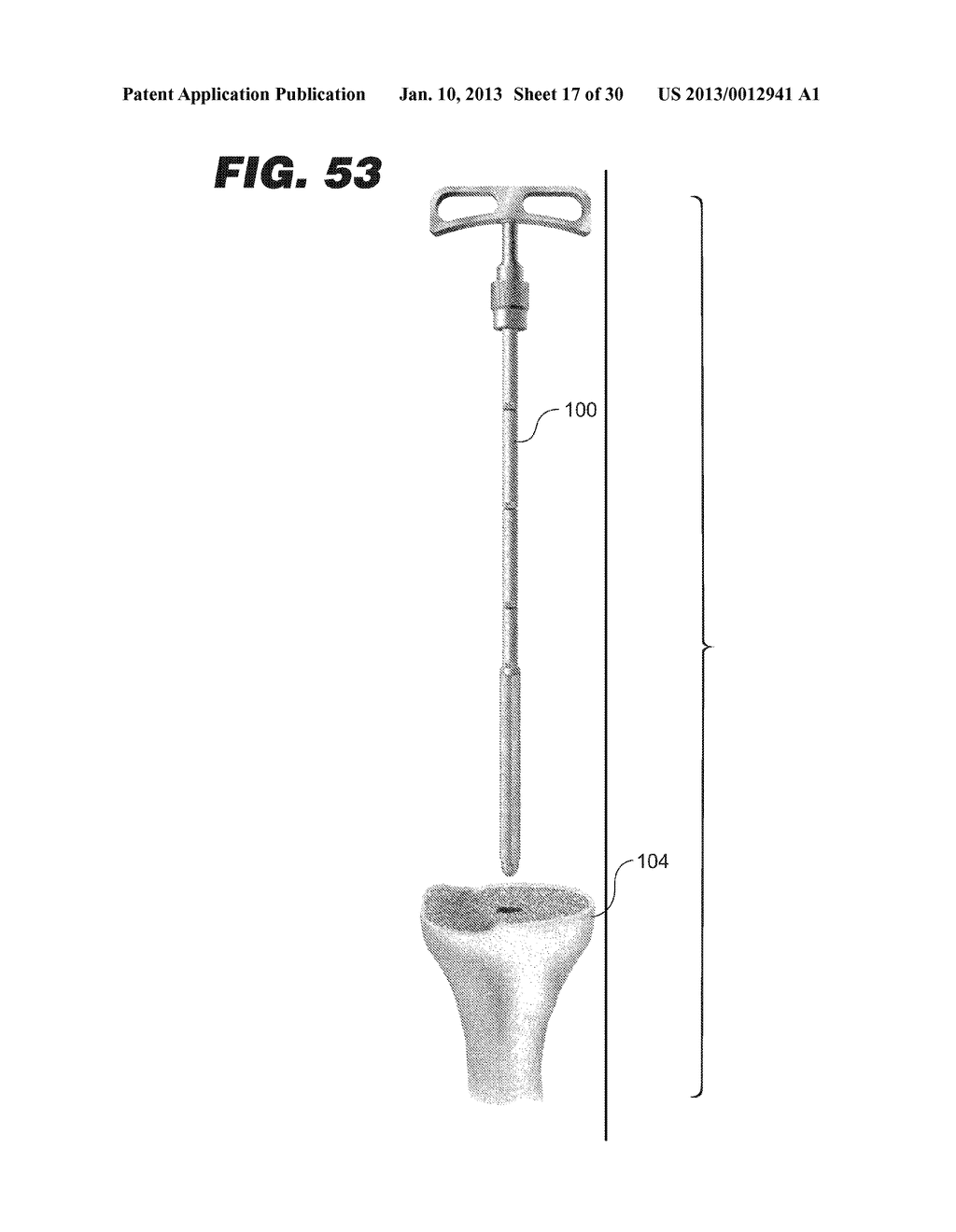 LOCKING INSTRUMENT ASSEMBLY - diagram, schematic, and image 18