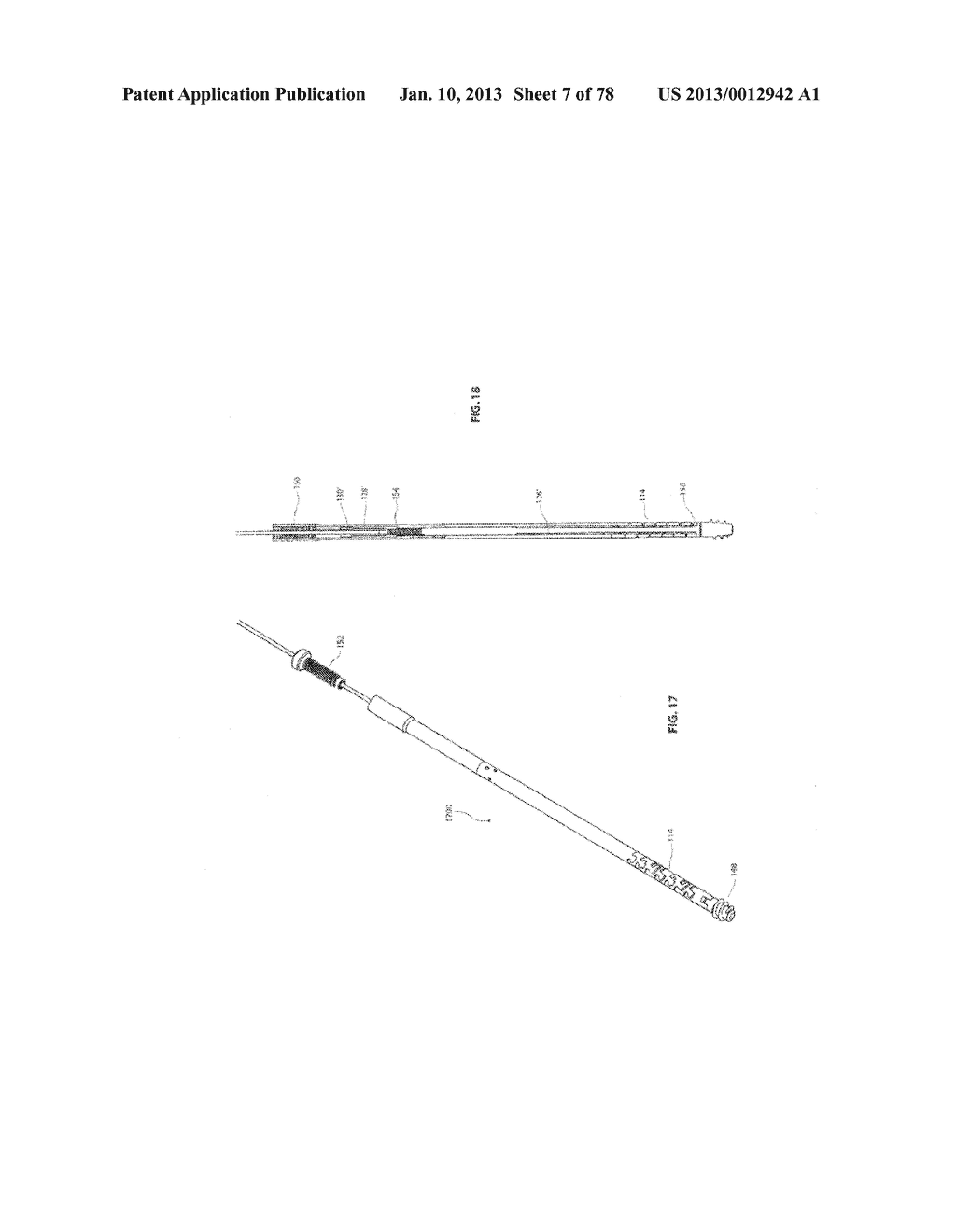 SEGMENTED INTRAMEDULLARY FRACTURE FIXATION DEVICES AND METHODS - diagram, schematic, and image 09