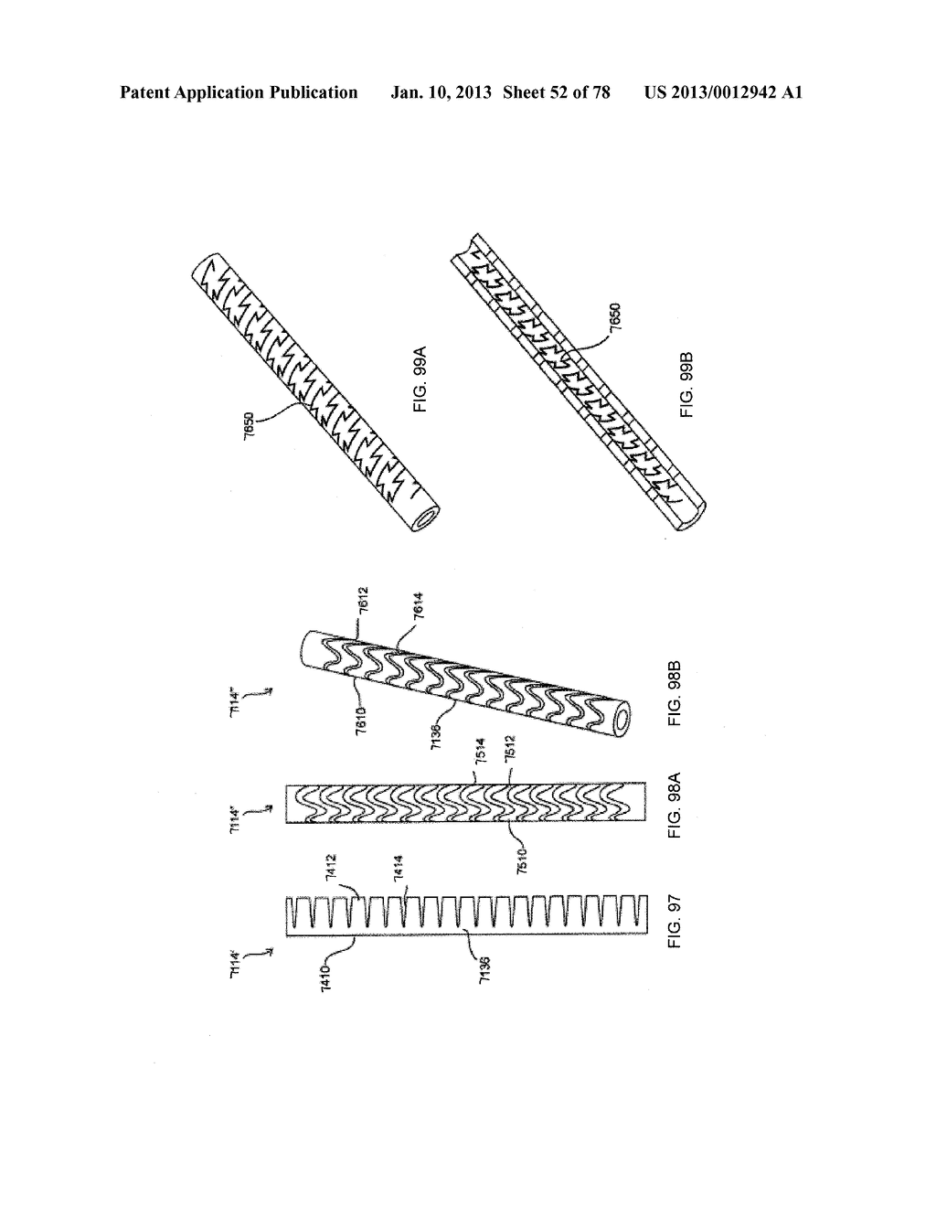 SEGMENTED INTRAMEDULLARY FRACTURE FIXATION DEVICES AND METHODS - diagram, schematic, and image 54