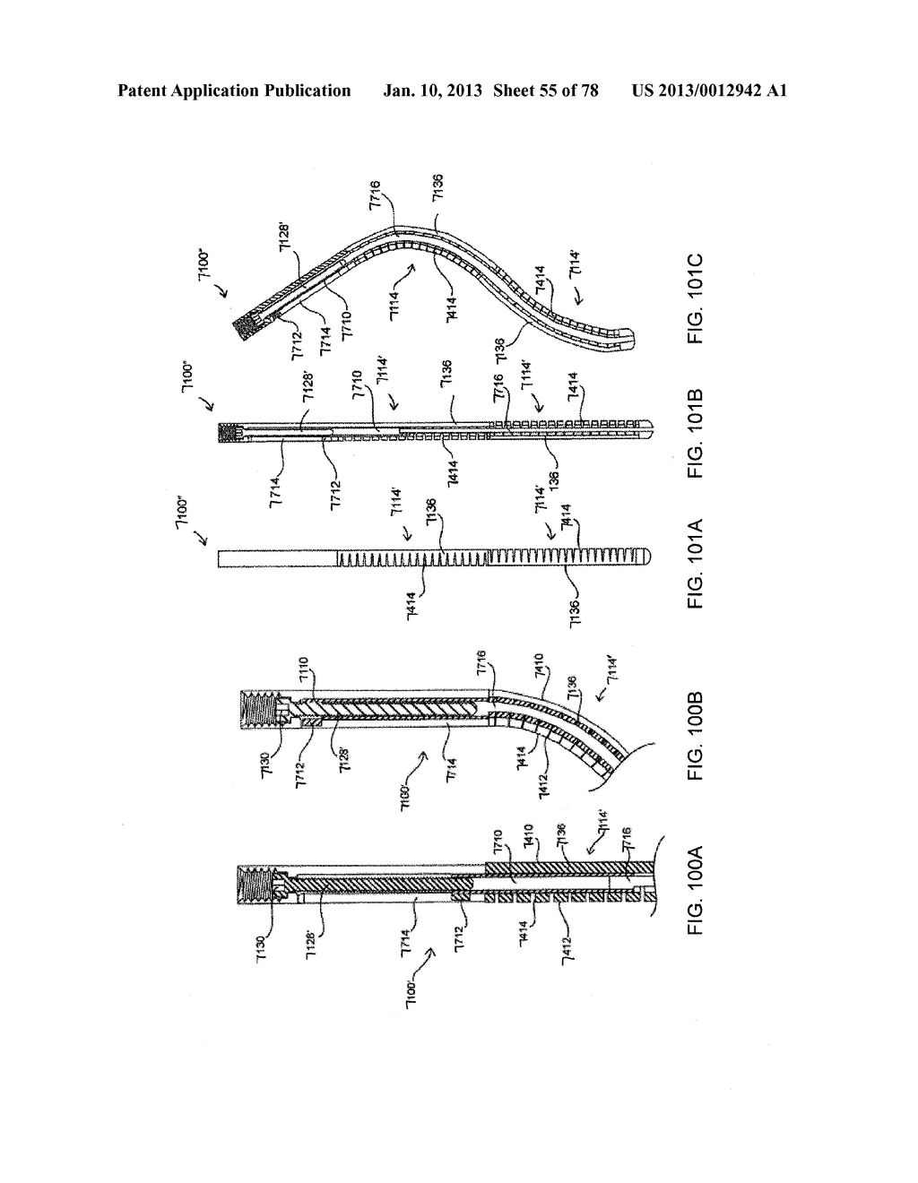 SEGMENTED INTRAMEDULLARY FRACTURE FIXATION DEVICES AND METHODS - diagram, schematic, and image 57