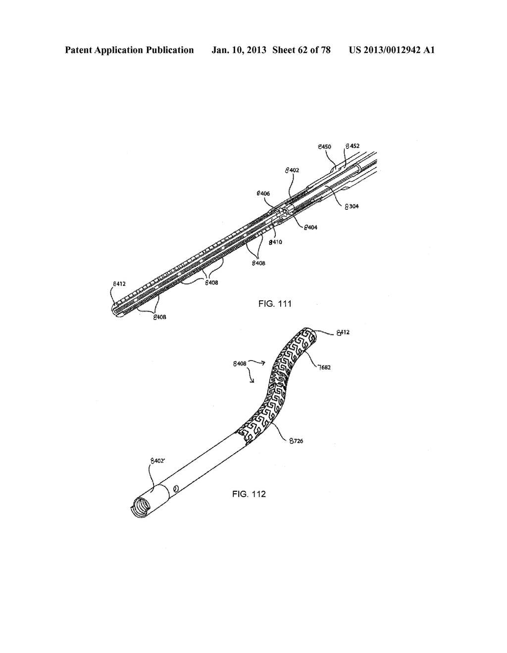 SEGMENTED INTRAMEDULLARY FRACTURE FIXATION DEVICES AND METHODS - diagram, schematic, and image 64