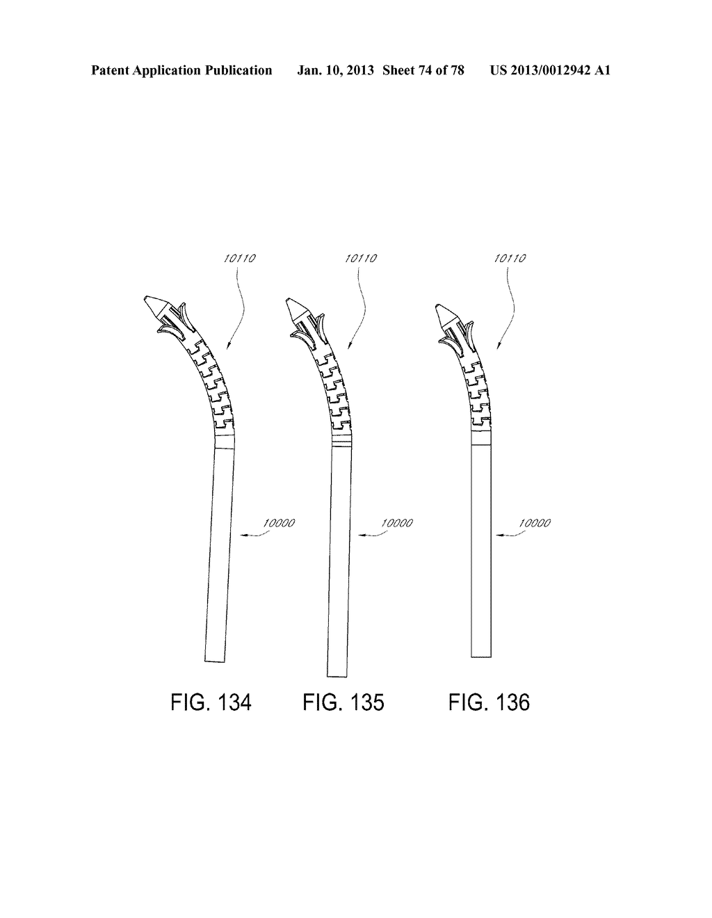 SEGMENTED INTRAMEDULLARY FRACTURE FIXATION DEVICES AND METHODS - diagram, schematic, and image 76