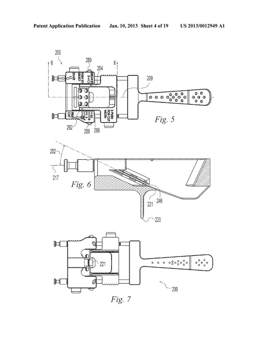 OSTEOTOMY GUIDE AND METHOD - diagram, schematic, and image 05