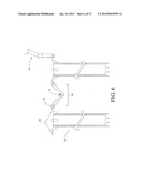 System and Method for Pedicle Screw Placement in Vertebral Alignment diagram and image