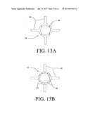 System and Method for Pedicle Screw Placement in Vertebral Alignment diagram and image