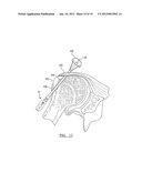 Method For Repairing A Meniscal Tear diagram and image