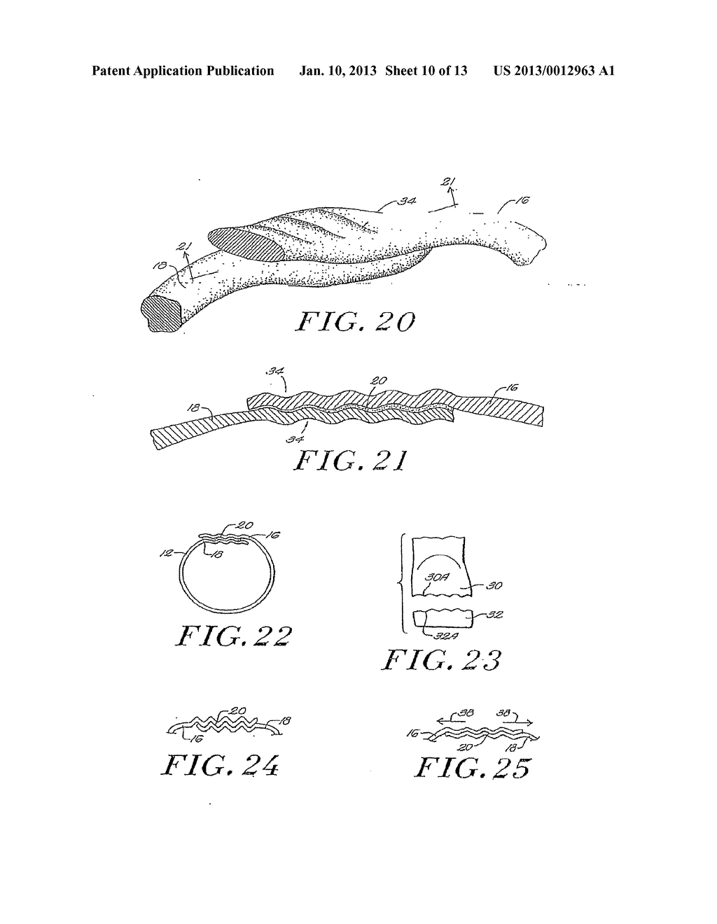 MULTICOMPONENT FUSED SUTURE LOOP AND APPARATUS FOR MAKING SAME - diagram, schematic, and image 11