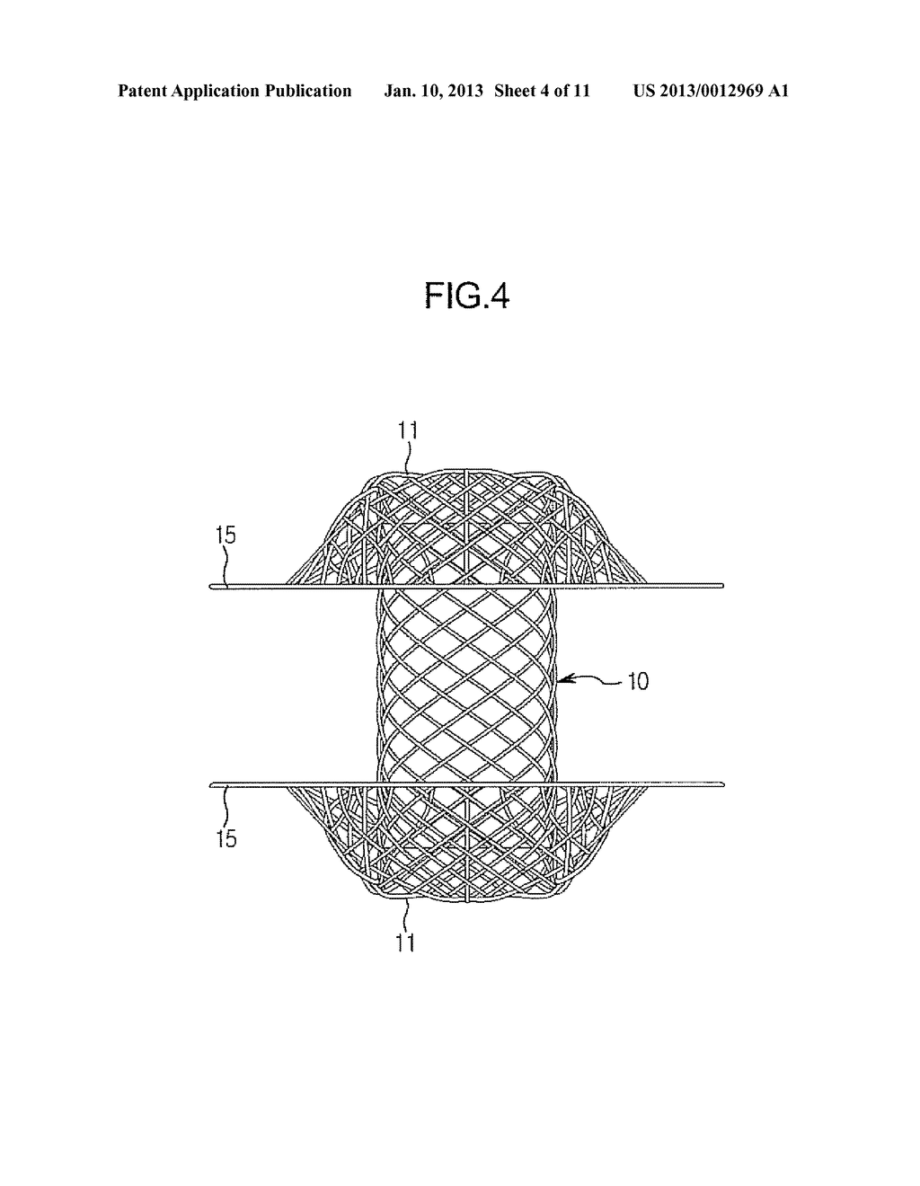 STENT FOR CONNECTING ADJACENT TISSUES OF ORGANS - diagram, schematic, and image 05