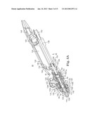 METHOD OF ENDOSCOPICALLY REMOVING TISSUE diagram and image