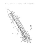 METHOD OF ENDOSCOPICALLY REMOVING TISSUE diagram and image