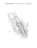 METHOD OF ENDOSCOPICALLY REMOVING TISSUE diagram and image