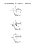 METHOD OF ENDOSCOPICALLY REMOVING TISSUE diagram and image