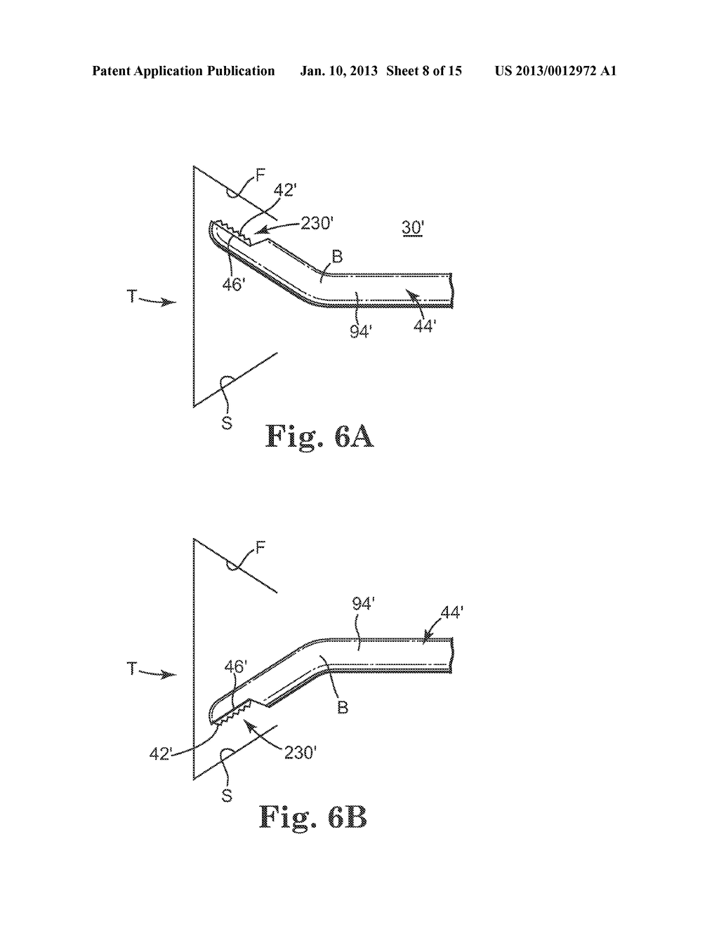 METHOD OF ENDOSCOPICALLY REMOVING TISSUE - diagram, schematic, and image 09