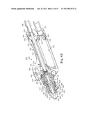 METHOD OF ENDOSCOPICALLY REMOVING TISSUE diagram and image