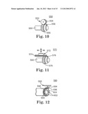 METHOD OF ENDOSCOPICALLY REMOVING TISSUE diagram and image