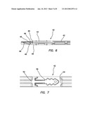 LAPAROSCOPIC SCISSORS diagram and image