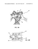 LAPAROSCOPIC SCISSORS diagram and image