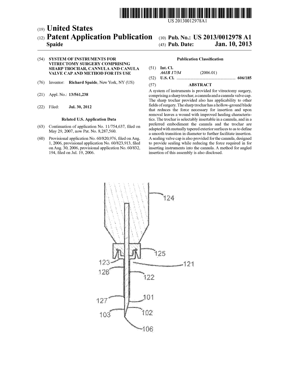 SYSTEM OF INSTRUMENTS FOR VITRECTOMY SURGERY COMPRISING SHARP TROCHAR,     CANNULA AND CANULA VALVE CAP AND METHOD FOR ITS USE - diagram, schematic, and image 01