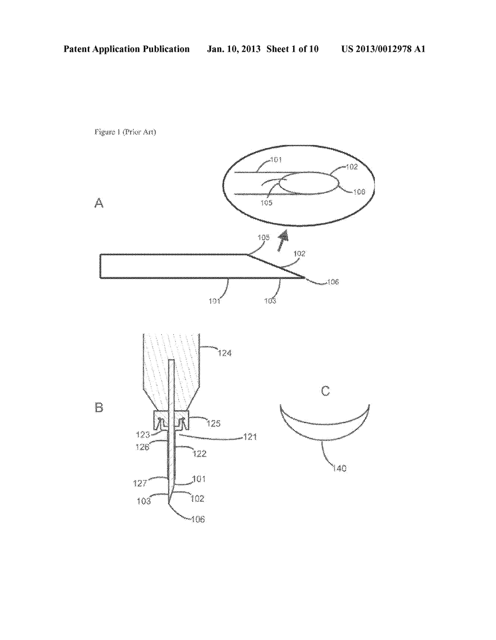 SYSTEM OF INSTRUMENTS FOR VITRECTOMY SURGERY COMPRISING SHARP TROCHAR,     CANNULA AND CANULA VALVE CAP AND METHOD FOR ITS USE - diagram, schematic, and image 02