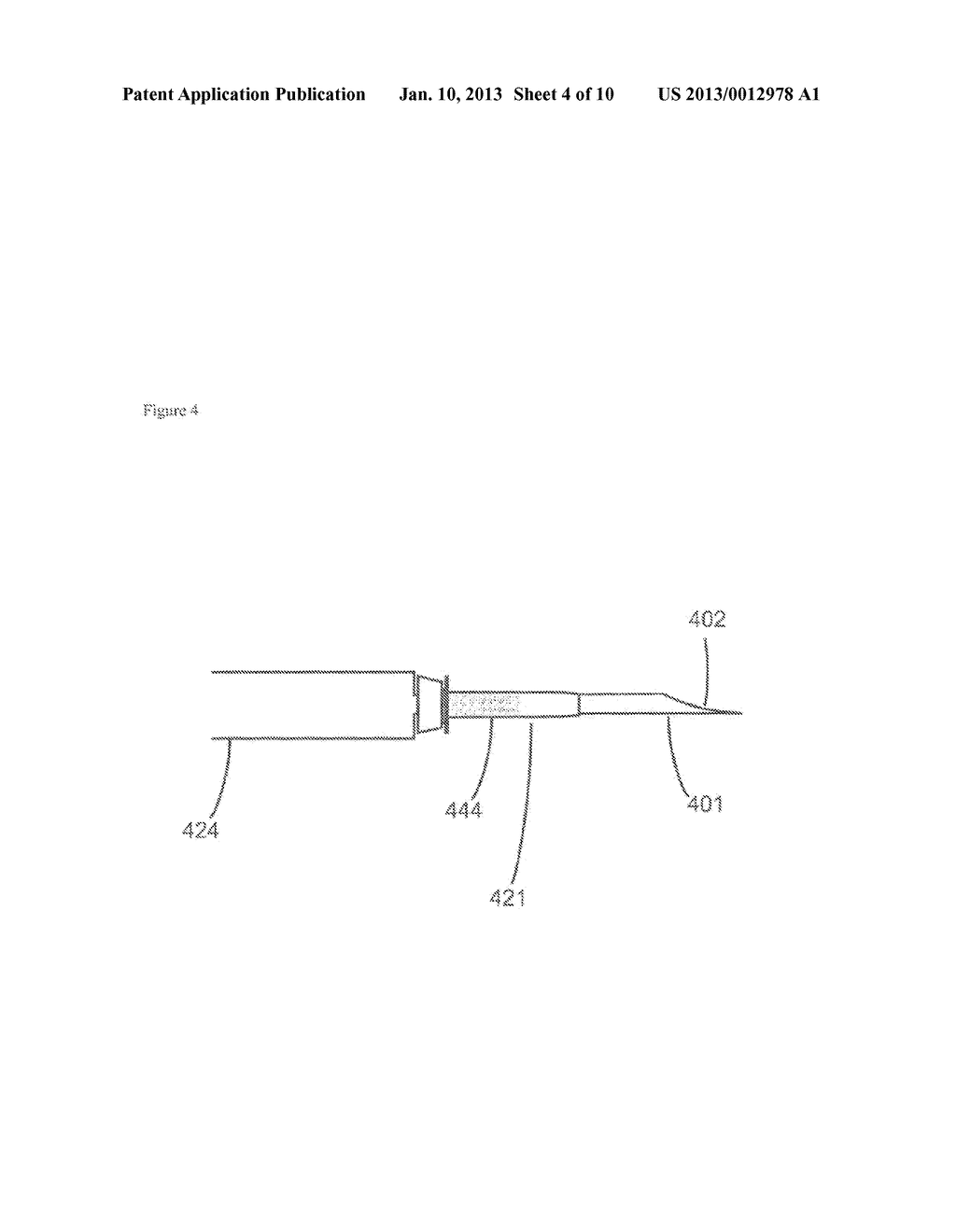 SYSTEM OF INSTRUMENTS FOR VITRECTOMY SURGERY COMPRISING SHARP TROCHAR,     CANNULA AND CANULA VALVE CAP AND METHOD FOR ITS USE - diagram, schematic, and image 05