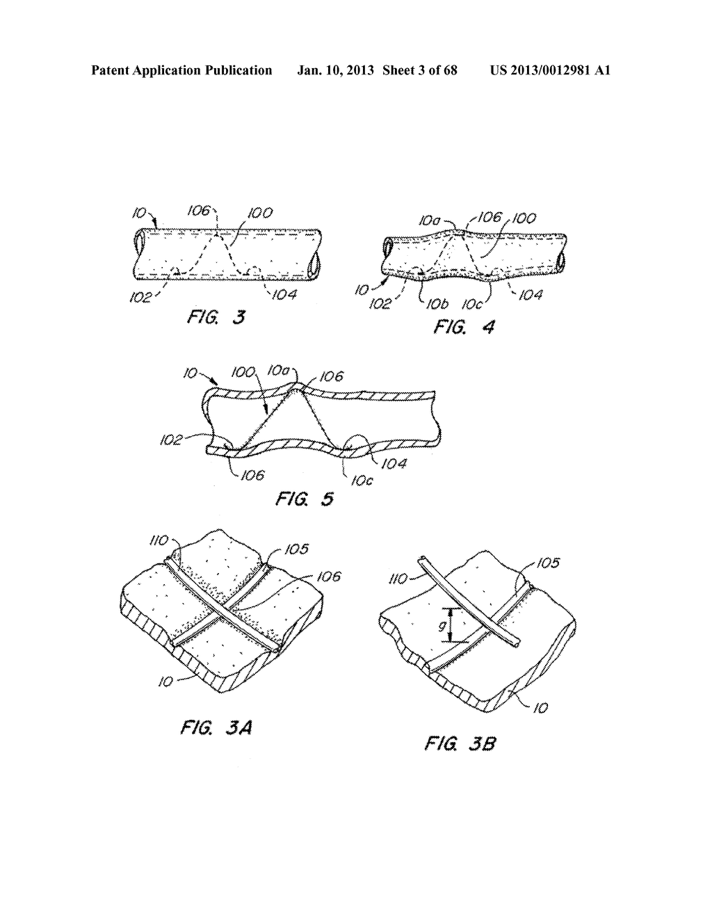 ENDOLUMINAL FILTER WITH FIXATION - diagram, schematic, and image 04