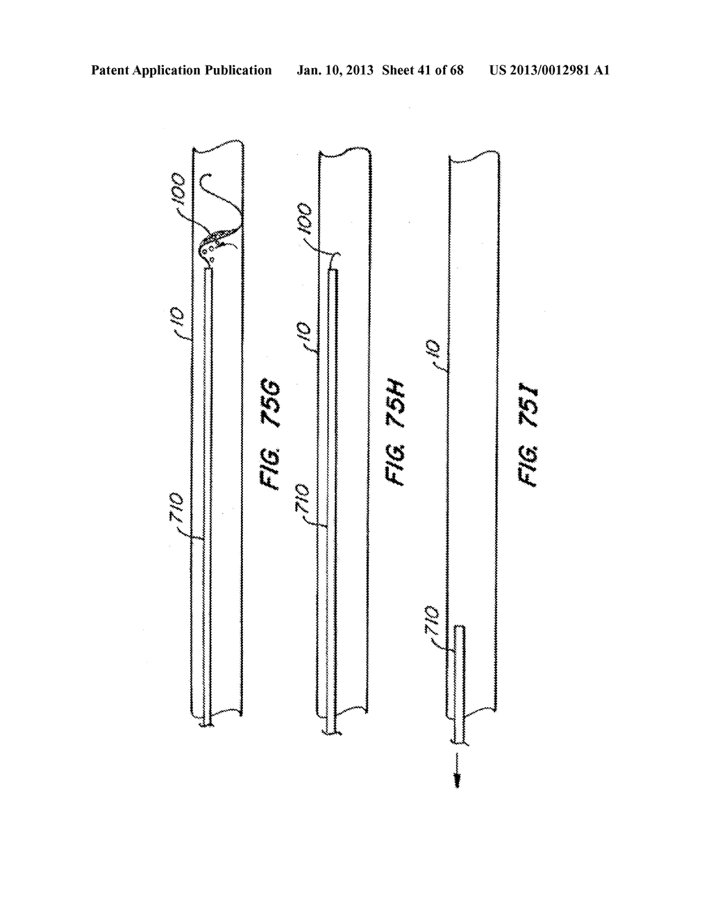 ENDOLUMINAL FILTER WITH FIXATION - diagram, schematic, and image 42