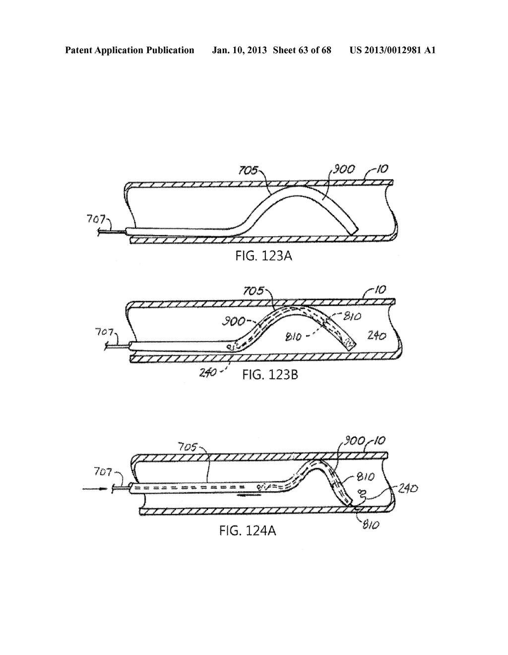 ENDOLUMINAL FILTER WITH FIXATION - diagram, schematic, and image 64