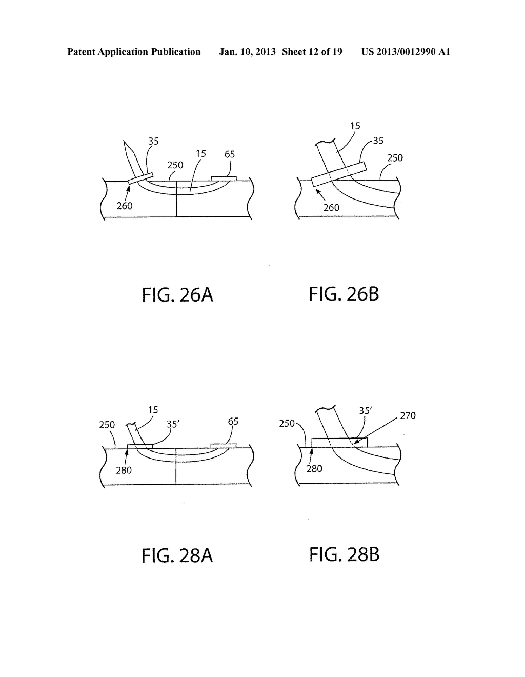 KNOTLESS LOCKING TISSUE FASTENING SYSTEM AND METHOD - diagram, schematic, and image 13