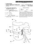 APPARATUS FOR COMPRESSING OR DECOMPRESSING A SPINAL DISC AND METHOD OF USE     THEREOF diagram and image