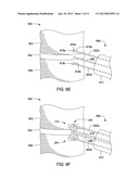 APPARATUS FOR COMPRESSING OR DECOMPRESSING A SPINAL DISC AND METHOD OF USE     THEREOF diagram and image