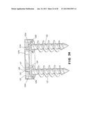 Cervical Plate Assembly diagram and image