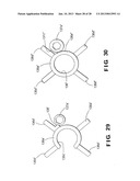 Cervical Plate Assembly diagram and image