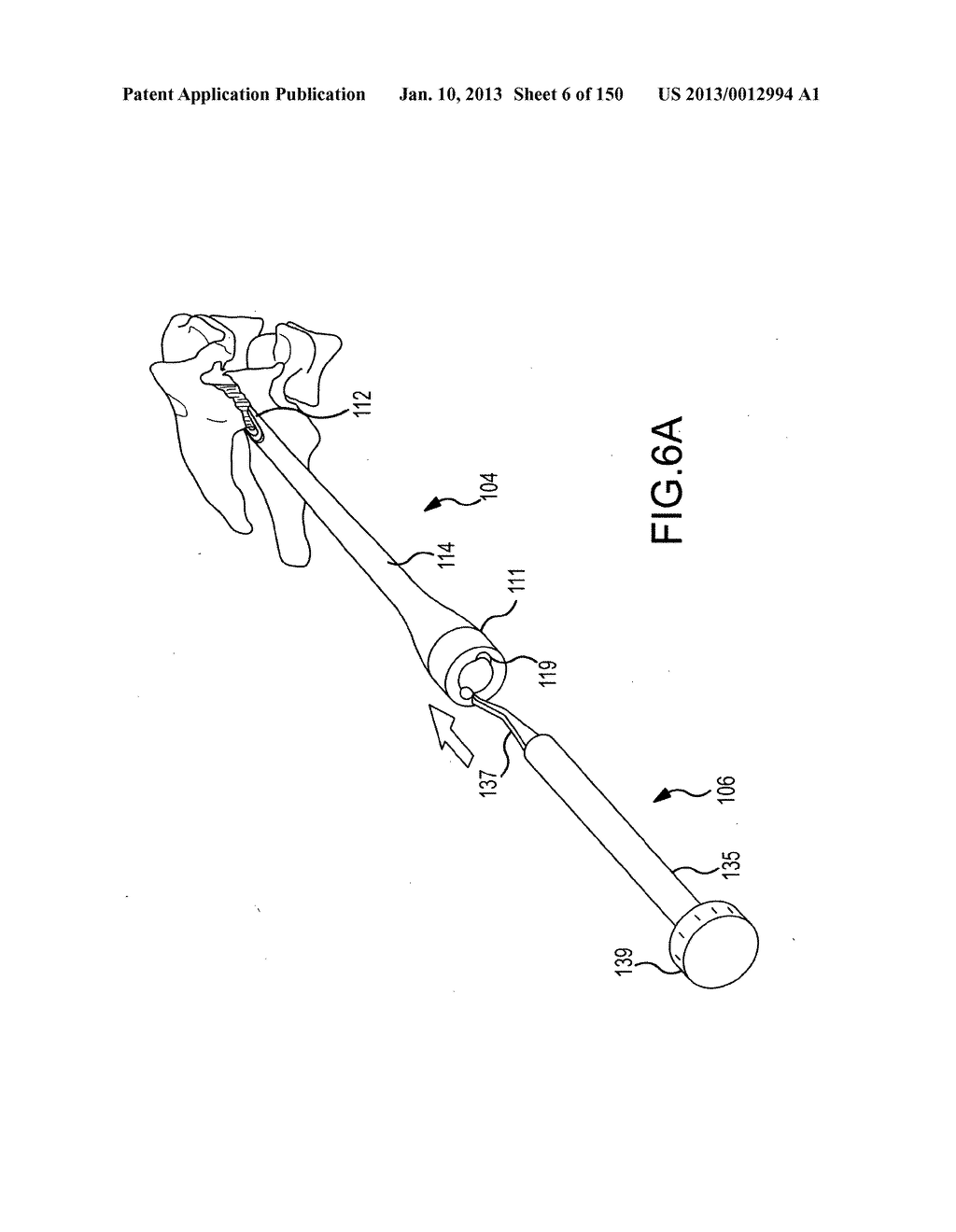 VERTEBRAL JOINT IMPLANTS AND DELIVERY TOOLS - diagram, schematic, and image 07